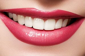 Hunt Valleny Cosmetic Dentistry, Cockeysville Teeth Whitening