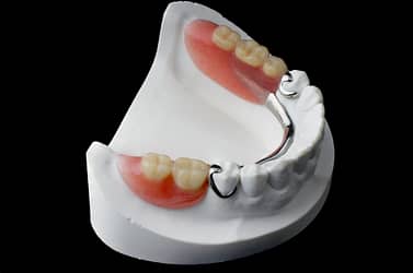 Partial Dentures1